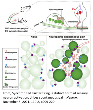 Synchronized cluster firing, a distinct form of sensory neuron activation, drives spontaneous pain.